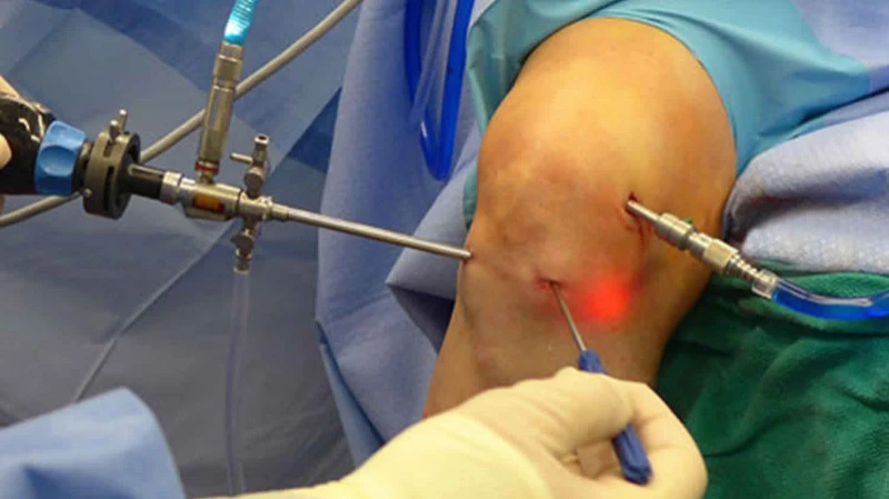The surgeon's hands at work