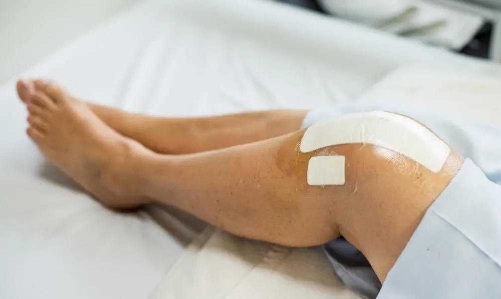 Your First Week After Total Knee Replacement: The Honest Recovery Guide