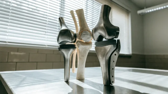 A partial knee component and a total knee component placed beside the same anatomical knee model, clearly different in scale but not presented as a competition