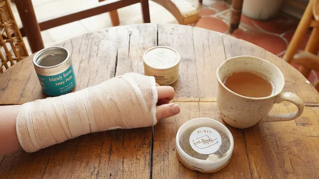 People-free fracture-care still life with bone models, imaging and orthopaedic equipment illustrating Recovering From a Wrist Fracture (Colles Fracture): Timeline and What to Expect